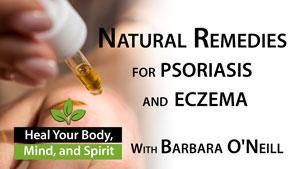 Home Remedies for Eczema and Psoriasis