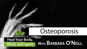 How to Prevent Osteoporosis